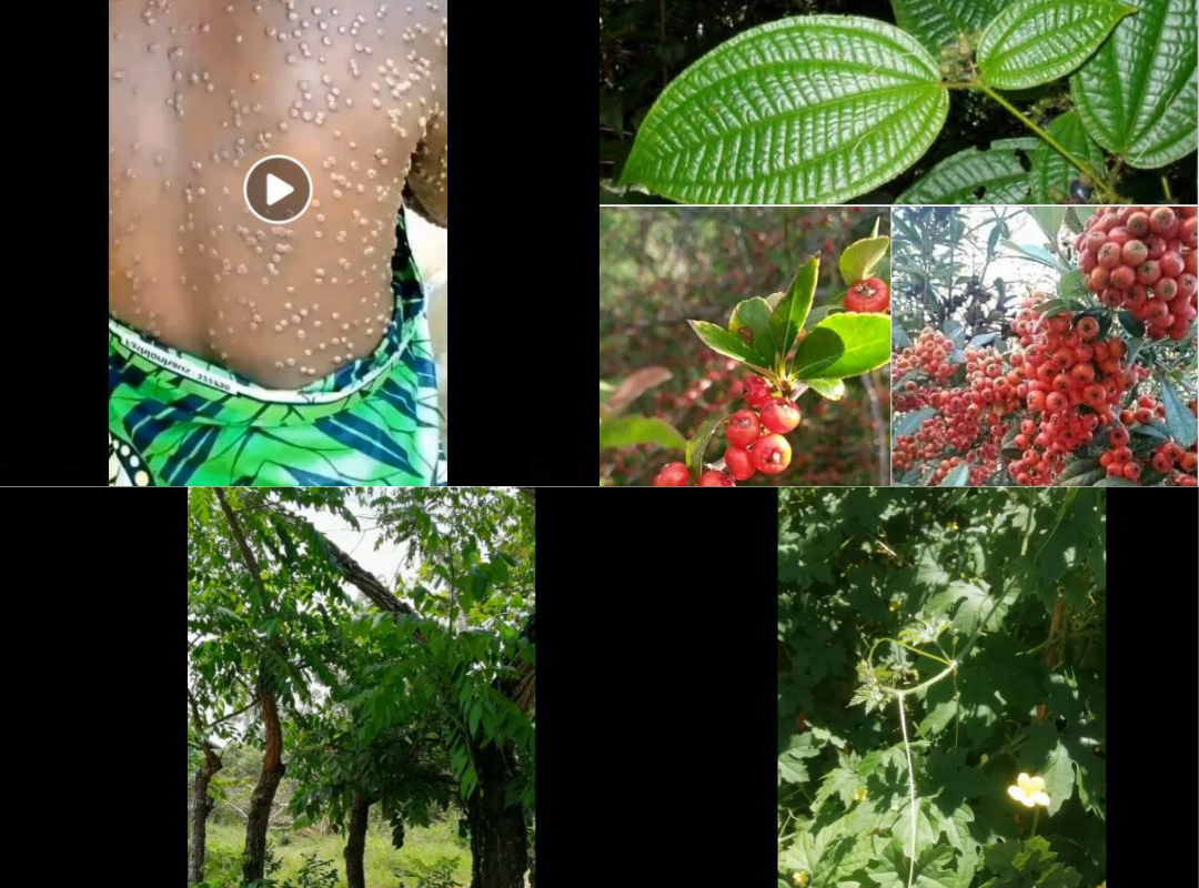 Les remèdes traditionnels guérissent-ils le Mpox ? Analyse d’affirmations relayées sur Facebook