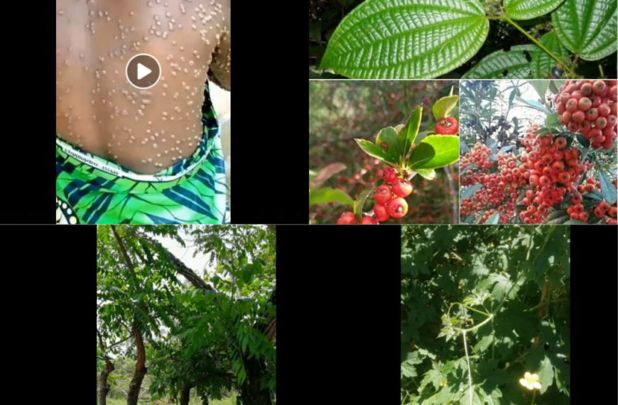 Les remèdes traditionnels guérissent-ils le Mpox ? Analyse d’affirmations relayées sur Facebook